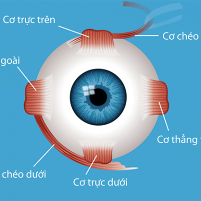 Phẫu thuật mắt lác (Mắt Lé) Và Những điều cần biết?